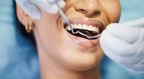 Best Emergency Treatment for Oral Infections in Collinsville, CT