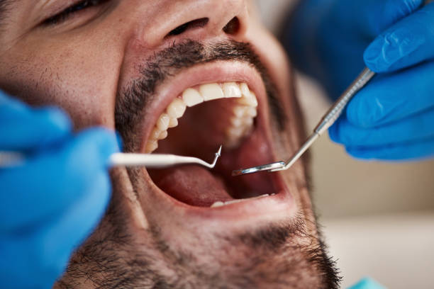 Best Emergency Treatment for Jaw Pain or Injury in Collinsville, CT